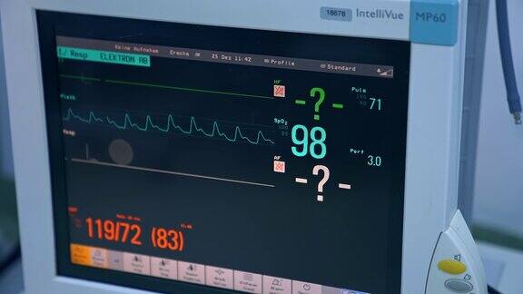 心率心电图心脏监护仪心跳显示心电图住院病人心脏监护仪心脏监测