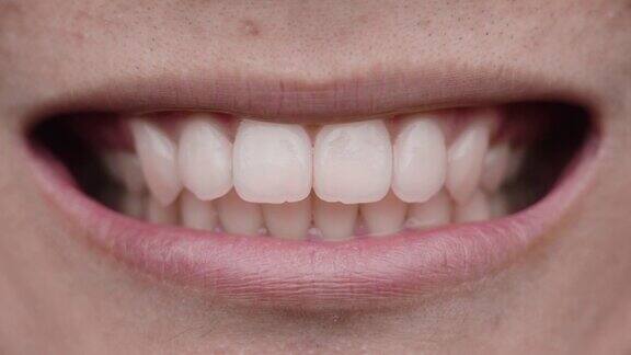 微笑的白牙齿
