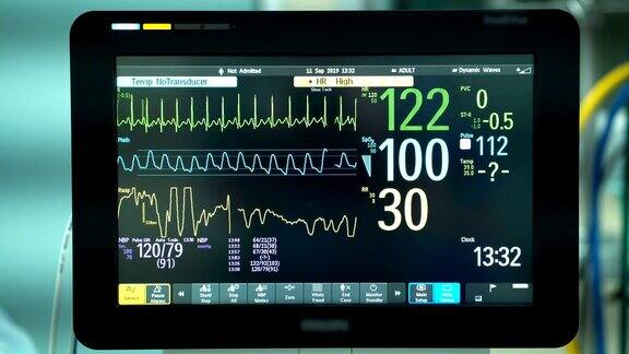 手术室心脏监护仪的关闭心电监护仪显示患者的心率背景