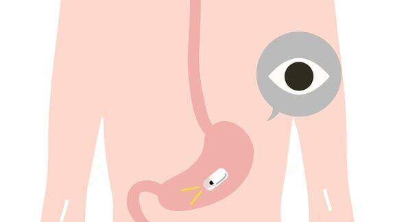 这是一个胃镜(胶囊)的动画视频Loopable
