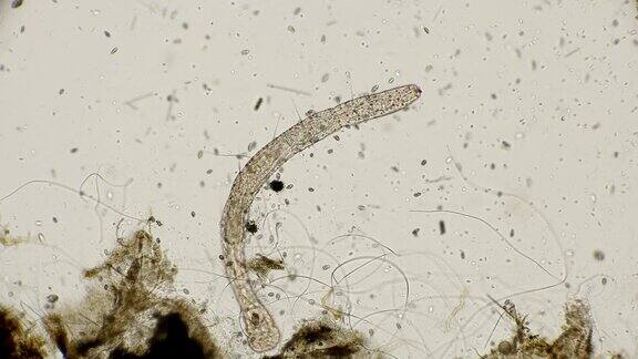 在显微镜下观察到的一种线虫