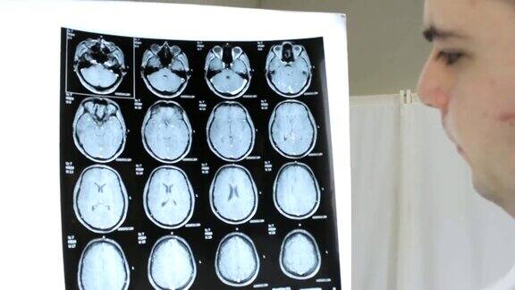 医生检查人类大脑的核磁共振成像诊断癌症