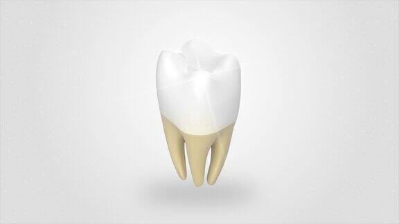 口腔卫生:牙齿清洁超声波刮除医学上精确的人类牙齿治疗的3D动画独立的3d视频