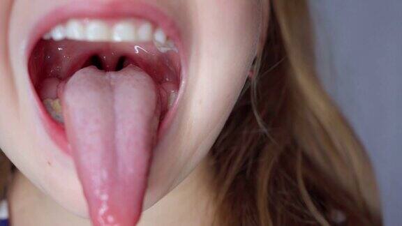 女孩张大嘴巴伸出长长的舌头孩子露出了他的牙齿