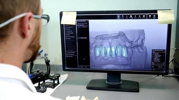 现代牙科牙齿矫正师在电脑上制作颌骨的3d模型