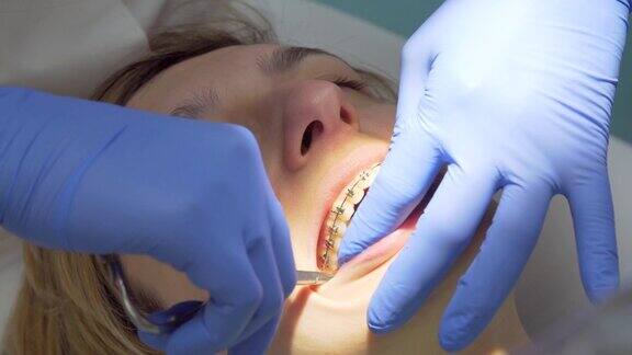 牙科诊所里戴着牙套的年轻女子