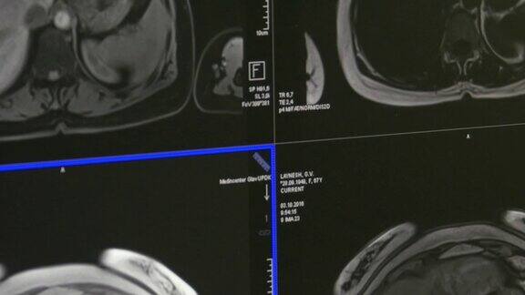 MRI脑部断层扫描专业医疗设备