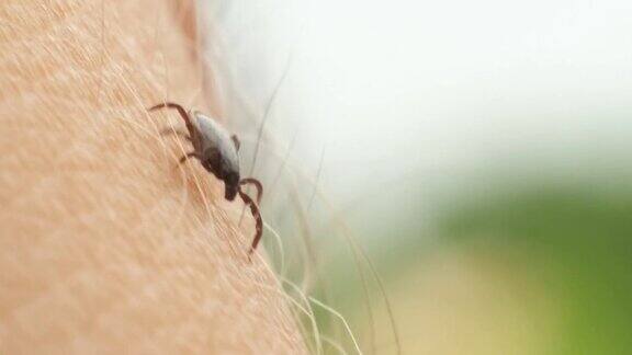 蜱虫在皮肤上行走-微距拍摄