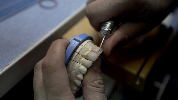 牙科技师为病人从零开始制造新牙齿牙科医生在牙科诊所用牙科设备在昏暗的光线下固定牙齿牙医准备牙齿