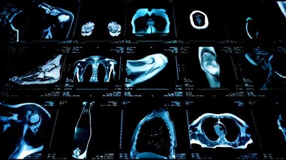 磁共振成像视频墙黑色和白色Loopable横向多莉