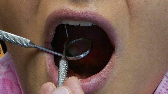 一个病人的嘴巴和牙医检查她的牙齿的近镜头