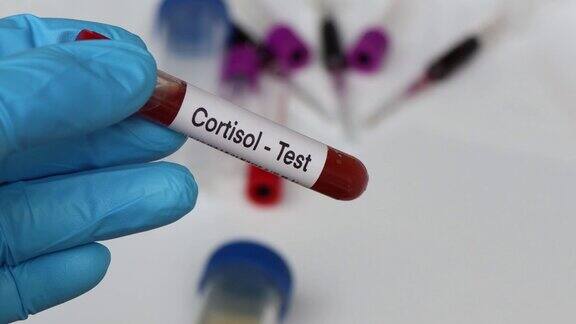 皮质醇测试从血液中寻找异常