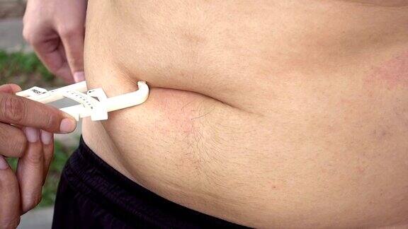 男人用皮肤折叠卡尺在他的腹部测量他的身体脂肪百分比