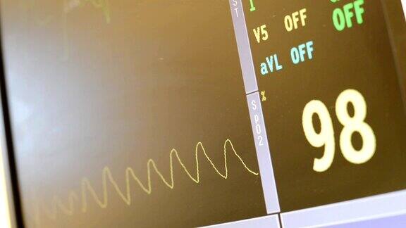 手术室和急诊室的心率监视器显示心跳