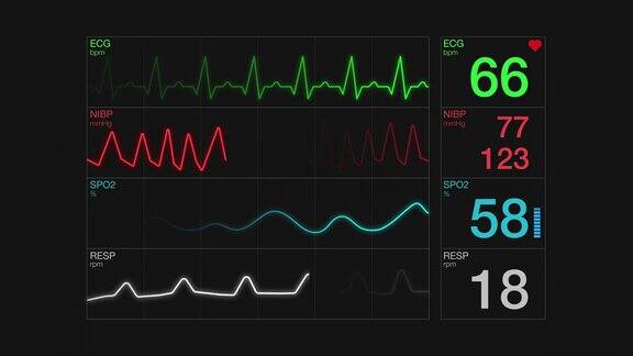 心电图心电图屏幕
