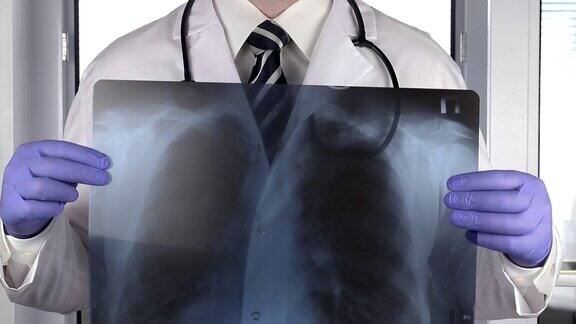 身穿白大褂的医生用听诊器显示肺部x光片肺炎和癌症