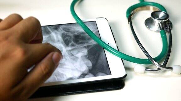 医生检查图像颅骨x射线MRI上的平板电脑医疗保健和医学概念