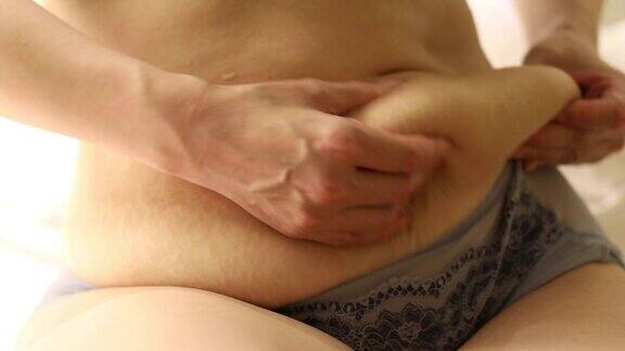 脂肪团和妊娠纹