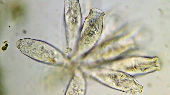 微生物-纤毛虫