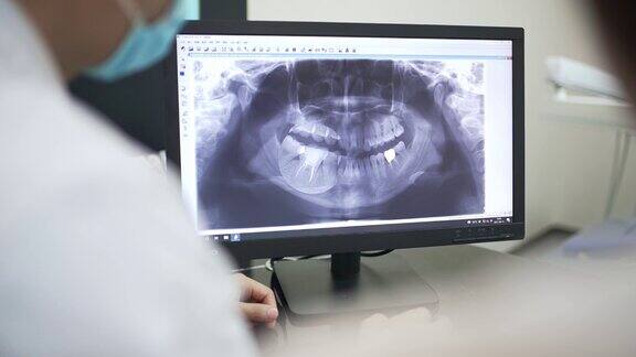 牙科医生在看x光片