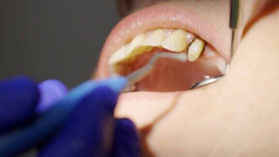 牙科医生在牙科诊所通过显微镜观察病人的牙齿