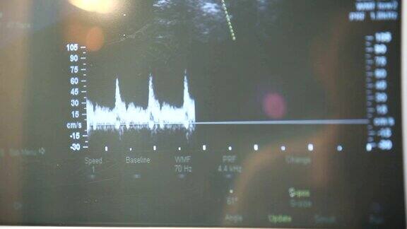 超声扫描仪在医学门诊特写显示