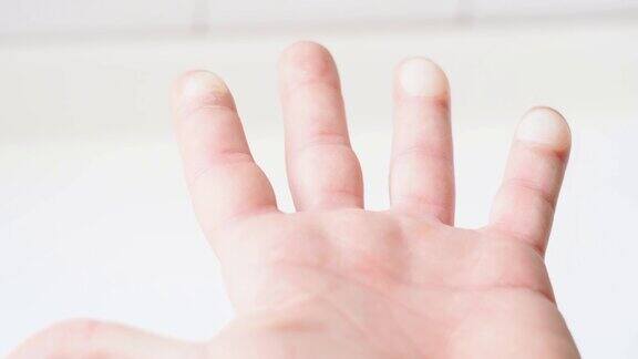 男性的手指尖有烧伤