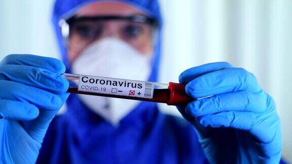冠状病毒COVID-19检测新型冠状病毒