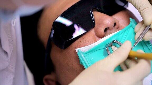 牙科医生用橡皮坝检查口腔内已安装的固化填料的状态