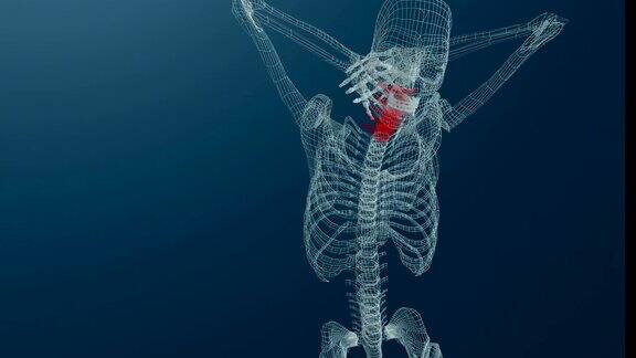 线框3d动画的骨骼与颈部疼痛蓝色背景
