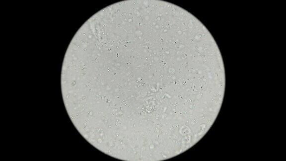 精子在显微镜下的运动