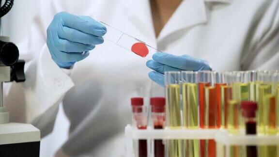 临床试验实验室科学家在显微镜下分析血液样本