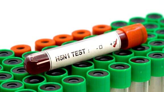 H5N1病毒阳性