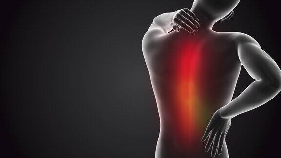 人类背部疼痛