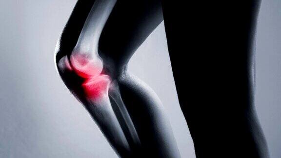 人体膝关节和腿部在x光片上在灰色背景上