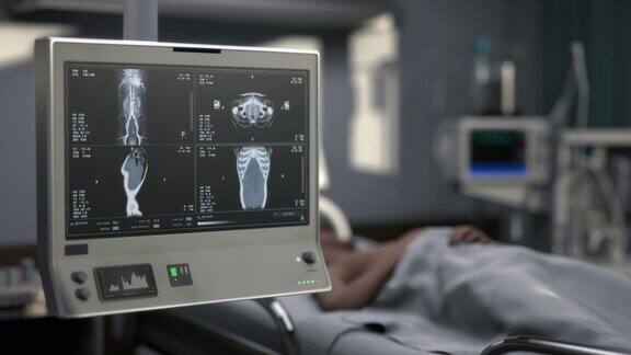 急诊医院x射线扫描仪对病人器官的医学检查