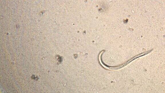 寄生虫线虫(圆线虫)显微镜观察活动寄生虫感染的运动形式在放大150倍