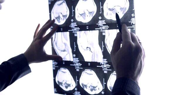 医生通过关节的x光片检查关节的MRI快照