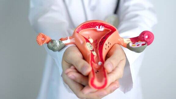 医生抱着子宫和卵巢模型卵巢癌和子宫颈癌宫颈疾病子宫内膜异位症子宫切除术子宫肌瘤生殖系统和怀孕