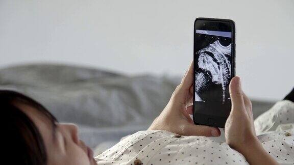 孕妇在智能手机上看超声波视频