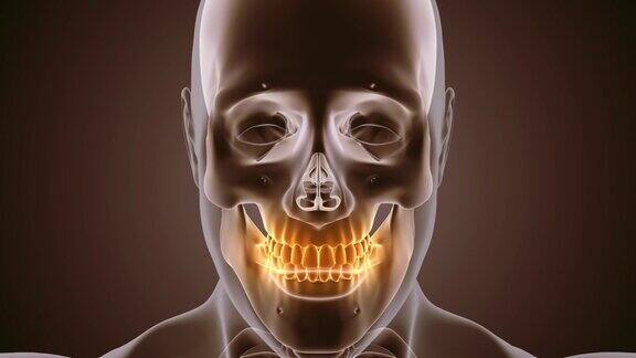 牙齿疼痛的医学动画
