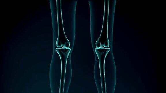 膝盖疼痛动画健康的关节和不健康的伴有骨关节炎疼痛的关节