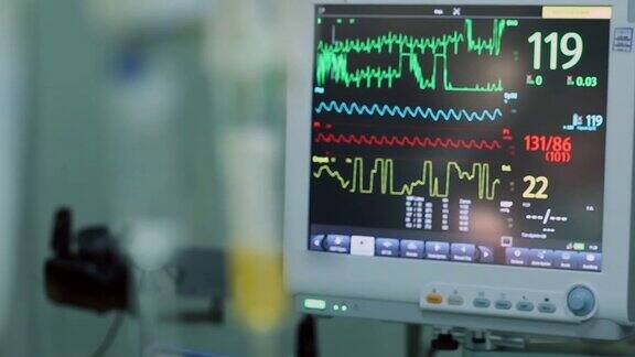 心电图监护仪滴管现代医院重症监护病房的医疗设备土耳其医院急诊室重症监护室脉搏追踪