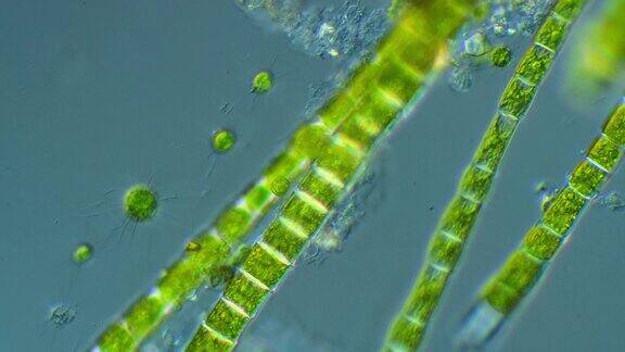 显微镜的纤毛虫