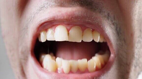 特写镜头那人露出了他那张歪歪扭扭的黄牙牙科保健概念