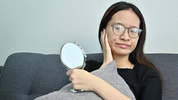 年轻的亚洲妇女担心引起痤疮炎症和痤疮疤痕发生在她的脸上而她在家里放松