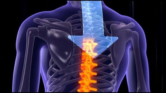 治疗背痛的抽象箭的动画