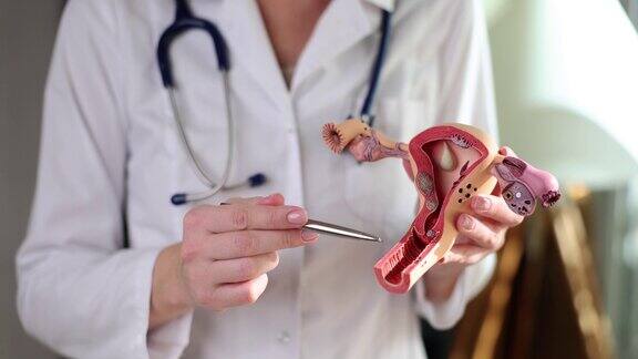 妇科医生展示子宫和卵巢病理解剖模型