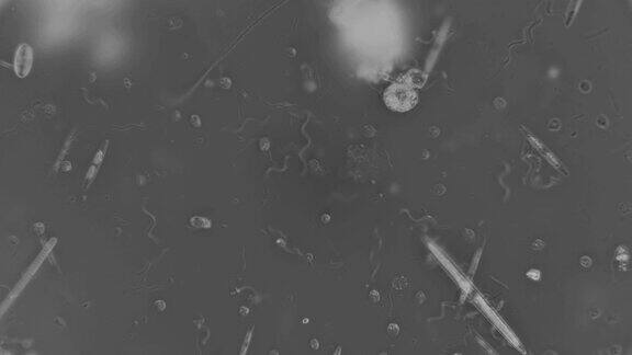 显微镜下的细菌螺旋体菌落