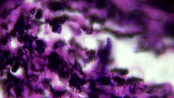 显微镜下烟肺有黑色沉积物